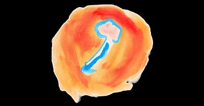 Cancer